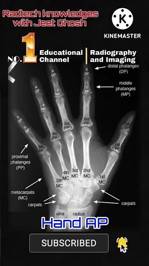 X-Ray hand Radiographic anatomy #xray #anatomy #radiography