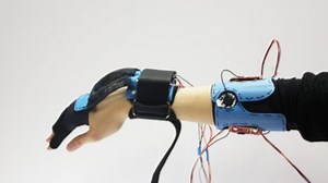 New Device Helps Children With Muscle Disease Move Their Hands