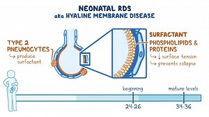Video: Neonatal respiratory distress syndrome: Clinical sciences - Video Explanation! | Osmosis | Osmosis