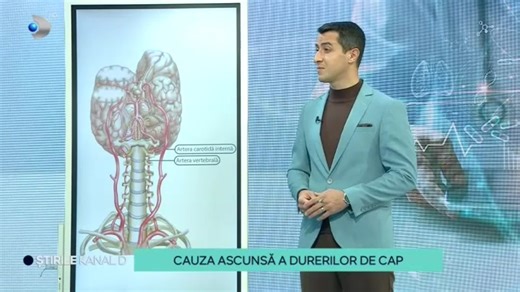 87K views · 1K reactions | V-ați întrebat vreodată ce provoacă durerile de cap apărute din senin? De multe ori nu e vorba nici de răceală și nici de oboseală, ci de la o problemă de coloană vertebrală. Cum ne dăm seama că acesta e motivul și ce variante de tratament avem, aflăm de la fizioterapeutul Alexandru Ilie. | Stirile Kanal D | Facebook
