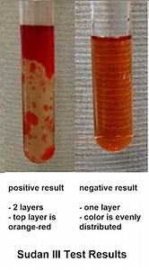 Topic 2: Biochemistry
