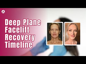 Deep Plane Facelift Recovery Timeline | Akm Clinic