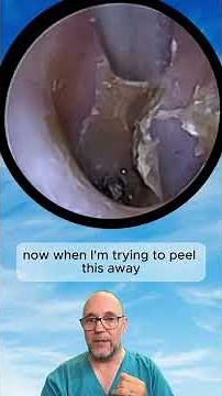 EAR DRUM PEEL! Full video in link below