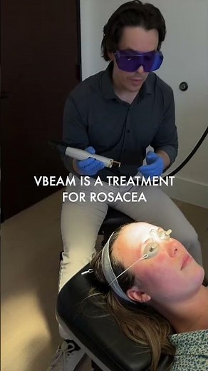 This laser clears rosacea redness (no downtime)