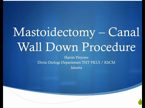 Step by step meatoplasti pada canal wall down tympanoplasty