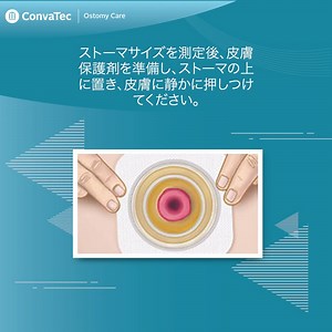 ストーマ装具を貼付する際には、貼付方法の手順を認識する必要があります。 二品系ストーマ装具の装着方法については、ビデオをご覧ください。 ストーマ装具の装着方法の基本については、リンクをクリックしてください。https://www.convatec.co.jp/ostomy/stoma-product-information/basic-application-of-a-stoma-system/ よろしければ、弊社ページの『いいね』と『フォロー』をお願いいたします❗ https://www.facebook.com/ConvaTec.JP/ #オストメイト #ストーマ #看護師 #訪問看護師 #ストーマ保有者 #ストーマ装具 #コンバテック #パウチ #小児オストメイト #若いオストメイト #よりそいつなぐ | コンバテック ジャパン