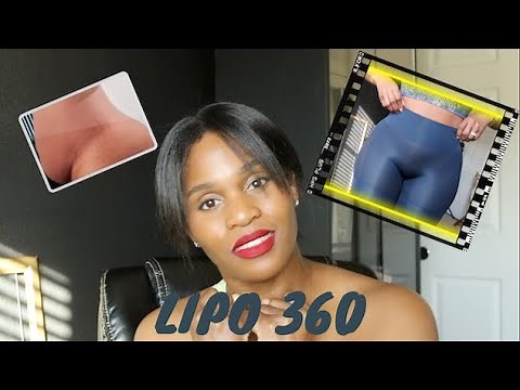 MY PLASTIC SURGERY STORY / I GOT LIPO 360 / ALL the DEETS / BEFORE and AFTER PICS | Withlove_Lisa