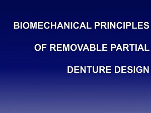 BIOMECHANICAL PRINCIPLES OF REMOVABLE PARTIAL DENTURE DESIGN - SlideServe