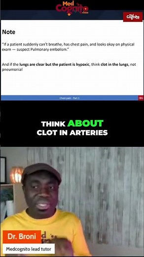 Pulmonary Embolism: Quick Guide to Diagnosis & Treatment #shorts