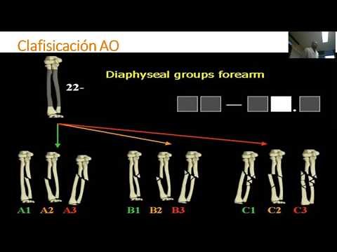 Fracturas de diáfisis de radio y cúbito, cabeza radial y olécranon