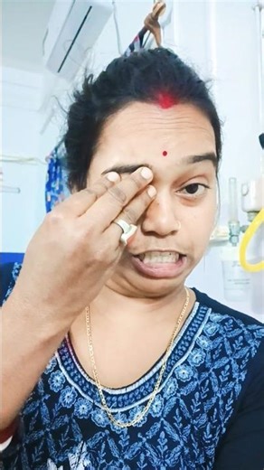 Fake Eye Drama 😱 Then Shouting “Show!”