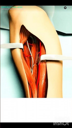 “Anterior Approach to the Forearm – Surgical Anatomy & Step-by-Step Procedure”