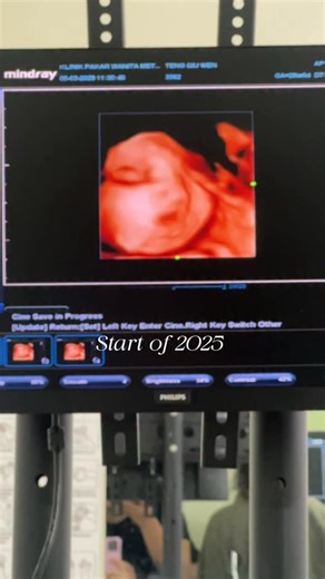 Baby Captain - 小队长 on Instagram: "2025年 我出生啦"