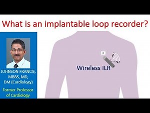 What is an implantable loop recorder?