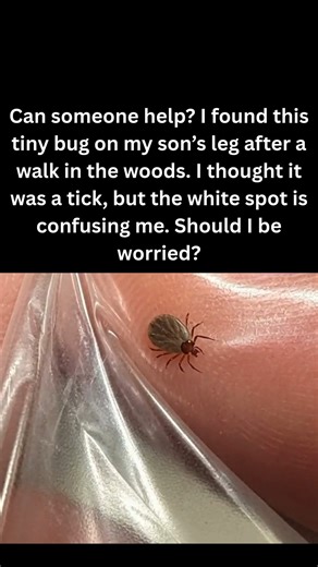 Has anyone seen this before, and should I be concerned? #TickCheck #OutdoorSafety #ParentingHelp #BugIdentification | Mycozytips