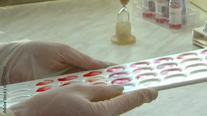 Blood testing for the group and RH factor, the average plan Stock Video