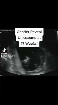 17 Weeks Pregnant: Gender Reveal Ultrasound!