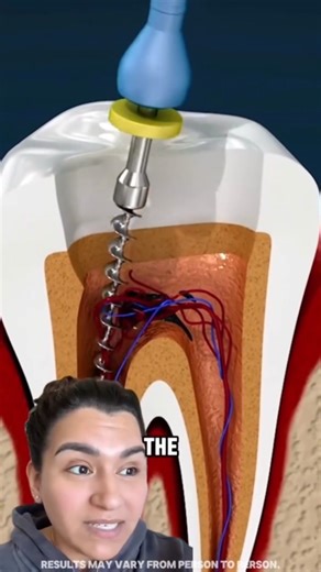 Your Smile’s Second Chance Starts Here ✅ Whitens teeth while eliminating bad breath and stains. ✅ Repairs enamel and reverses early-stage cavities naturally. ✅ Clinically proven nano-hydroxyapatite formula — dentist approved. Get Yours Now - Buy 1 Get 1 FREE! | Dentoxyl | Facebook