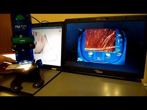 Intelplay QX3 Computer Microscope