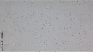 Healthy human sperm through microscope