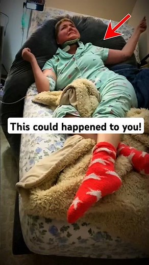 Stiff Person Syndrome: Rare but Real