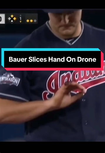 Injuries outside of the game always hurt the team. #baseball #mlb #dodgers #yankees #sports