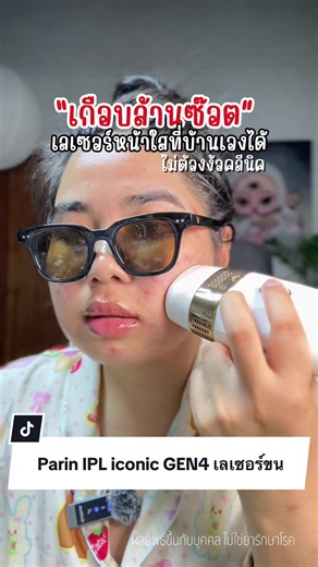 Parin IPL iconic GEN4 เลเซอร์ขนรักแร้