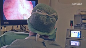 En bloc resection of bladder tumors with HybridKnife - Medical Videos