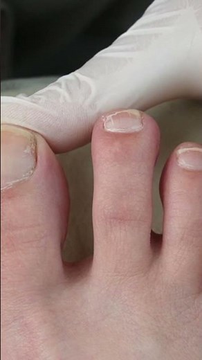What Happens During a Podiatrist Visit