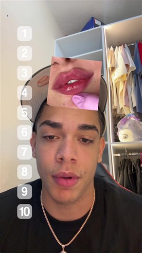 Ranking de labios: de lo natural a lo operado