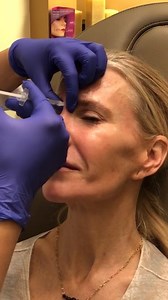 Fast and Easy Botox Treatment