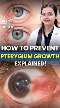 How to Prevent Pterygium from Growing | Eye Protection Tips 👀