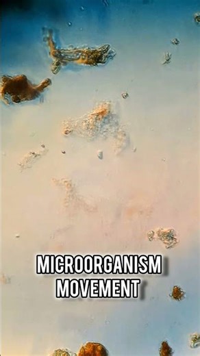 Protist movement #microcosmos #microscope