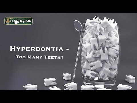 What Is Hyperdontia? Treatment and Causes | Dental care | Health Advice
