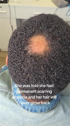 Find Effective Solutions for Hair Loss in 2026