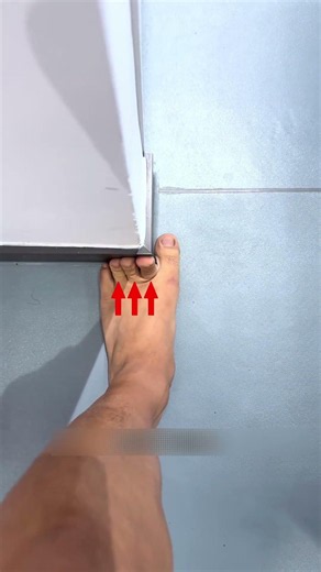 Fix Flat Feet Before They Ruin Your Ankles!