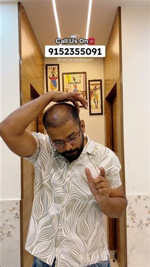 Day 21 - Which Medicines Will Start After Hair Transplant?