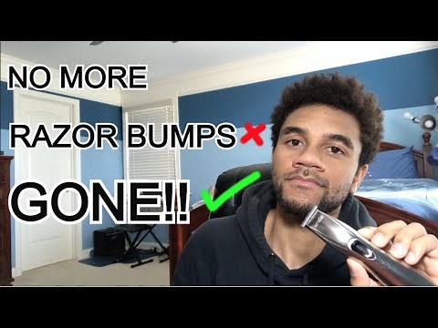 HOW TO PREVENT RAZOR BUMPS - Treat Razor Bumps & Ingrown Hairs
