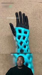 52K views · 362 reactions | El yeso del futuro ( CAST 21 ) ✅ #reels #viralreels #reelsvideo #reelsviral #fblifestyle | Ervin Creator | Facebook