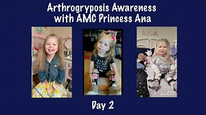 34K views · 1.7K reactions | DAY 2 - Ana talks about contractures....