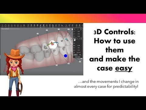 Invisalign ClinCheck Modifications with 3D Controls.