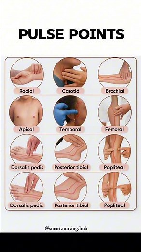 "Here are the major pulse points every medical student should know. 🩺"