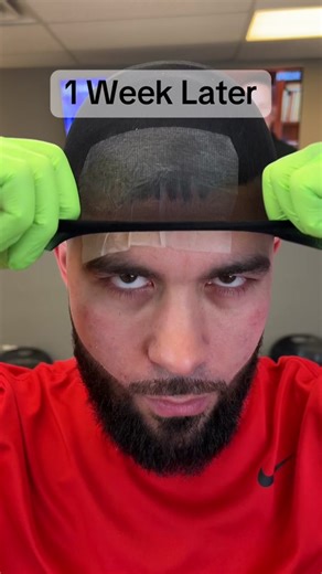 Tame Cowlicks with Effective Hair Perm Techniques