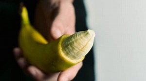 Dokter Bedah Anak Kupas Tuntas Tujuan Khitan dan Manfaatnya - TribunHealth.com