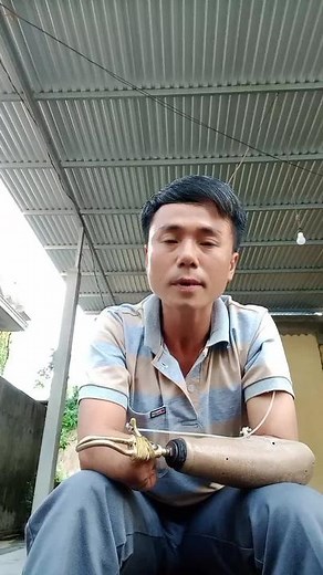 Understanding Life with a Prosthetic Arm