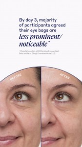 Obagi Daily Hydro-Drops Rejuvenating Eye Gel Cream – Reduces the Appearance of Dark Circles & Instantly Brightens, Smooths, & Depuffs Eyes – 0.5 oz