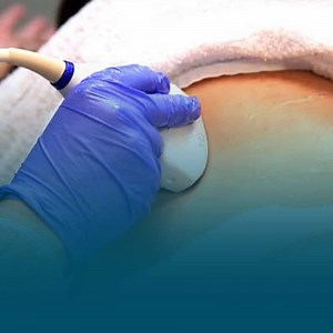 Liver Elastography at OIC