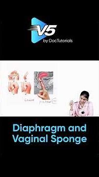 Diaphragm vs Vaginal Sponge: Proper Usage and Safety Tips Explained