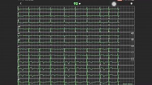 心电图学习软件ECG