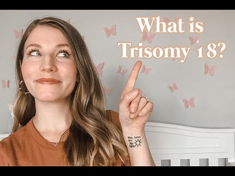 What is Trisomy 18? Edward's Syndrome | Trisomy 18 101